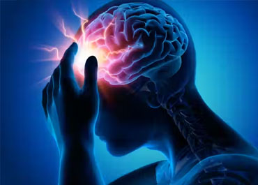 Migraine