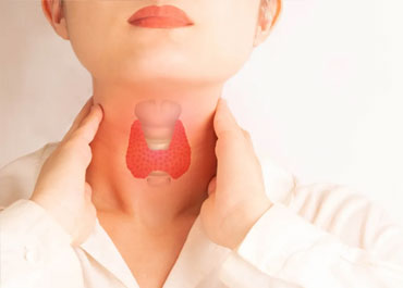 Thyroid