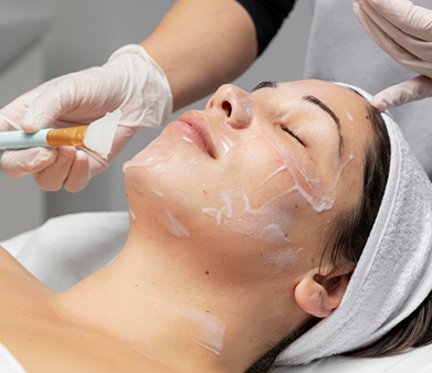 Chemical Peeling Treatment